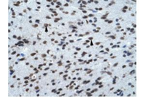 KCNK13 antibody was used for immunohistochemistry at a concentration of 4-8 ug/ml to stain Neural cells (arrows) in Human Brain.