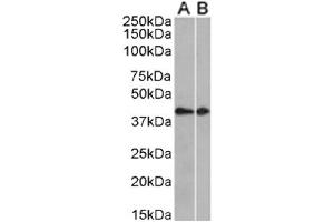 Western Blot using anti-CCRL2 antibody. (Rekombinanter CCRL2 Antikörper  (AA 1-24))
