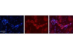 Rabbit Anti-PHF1 Antibody   Formalin Fixed Paraffin Embedded Tissue: Human heart Tissue Observed Staining: Cytoplasmic in endothelial cells in blood vessels Primary Antibody Concentration: 1:100 Other Working Concentrations: 1:600 Secondary Antibody: Donkey anti-Rabbit-Cy3 Secondary Antibody Concentration: 1:200 Magnification: 20X Exposure Time: 0. (PHF1 Antikörper  (C-Term))