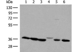 Western blot analysis of 293T and A375 cell lysates using LDHA Polyclonal Antibody at dilution of 1:250 (Lactate Dehydrogenase A Antikörper)