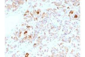 IHC testing of FFPE human pituitary gland stained with Luteinizing Hormone alpha antibody (clone LHa/756). (LH alpha Antikörper)