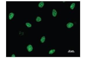Immunostaining analysis in HeLa cells. (ASH2L Antikörper)