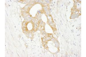 Immunohistochemistry (IHC) image for anti-Eukaryotic Translation Initiation Factor 3 Subunit J (EIF3S1) (AA 208-258) antibody (ABIN7448547) (EIF3S1 Antikörper  (AA 208-258))