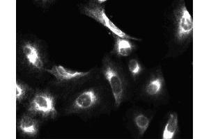 Immunofluorescent staining of A549 (ATCC CCL-185) cells. (PIK3CA Antikörper  (AA 562-724))