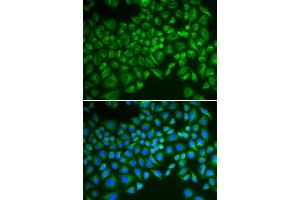 Immunofluorescence analysis of MCF-7 cells using SELE antibody. (Selectin E/CD62e Antikörper)