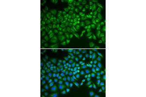 Immunofluorescence analysis of MCF-7 cells using SELE antibody. (Selectin E/CD62e Antikörper)