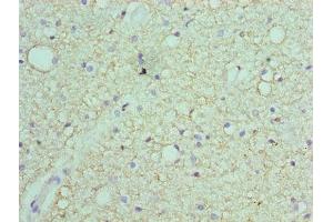 Immunohistochemistry of paraffin-embedded human brain tissue using ABIN7168870 at dilution of 1:100 (Septin 7 Antikörper  (AA 308-437))