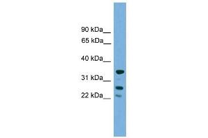 H1FOO antibody used at 1 ug/ml to detect target protein. (H1FOO Antikörper  (Middle Region))