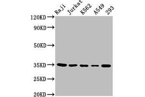 Western Blot Positive WB detected in: Raji whole cell lysate, Jurkat whole cell lysate, K562 whole cell lysate, A549 whole cell lysate, 293 whole cell lysate All lanes: TAL1 antibody at 5. (TAL1 Antikörper  (AA 1-114))