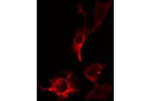 ABIN6275356 staining HepG2 cells by IF/ICC. (PITPNB Antikörper  (C-Term))