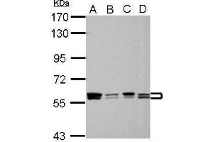 WB Image Sample (30 ug of whole cell lysate) A: 293T B: A431 C: HeLa D: HepG2 7. (PTBP1 Antikörper)
