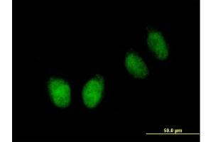 Immunofluorescence of purified MaxPab antibody to NUB1 on HeLa cell.