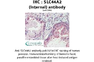 Image no. 2 for anti-Solute Carrier Family 44, Member 2 (SLC44A2) (Internal Region) antibody (ABIN1739381)