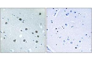Immunohistochemistry analysis of paraffin-embedded human brain tissue, using MYO1D Antibody. (Myosin ID Antikörper  (AA 825-874))