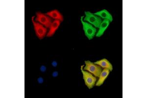ABIN7095934 and ABIN7099996 staining Hela cells by IF/ICC.
