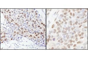 anti-Retinoblastoma Binding Protein 7 (RBBP7) (C-Term) antibody