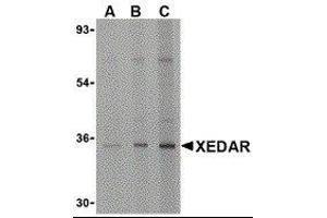 Western Blotting (WB) image for anti-Ectodysplasin A2 Receptor (EDA2R) antibody (ABIN2477154) (Ectodysplasin A2 Receptor Antikörper)