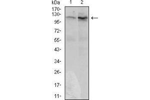 Western blot analysis using DIS3L2 mouse mAb against Hela (1) and HepG2 (2) cell lysate. (DIS3L2 Antikörper  (AA 27-250))
