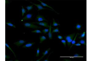 Immunofluorescence of purified MaxPab antibody to CCND2 on HeLa cell. (Cyclin D2 Antikörper  (AA 1-289))