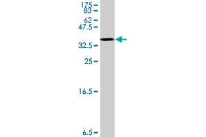 Image no. 4 for anti-Stomatin (STOM) (AA 59-142) antibody (ABIN1327677)