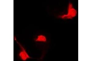 Immunofluorescent analysis of STAT5B staining in Hela cells. (STAT5B Antikörper)