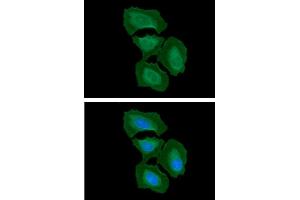 ICC/IF analysis of ITGB1 in HeLa cells.