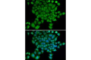 Immunofluorescence analysis of U2OS cells using NEDD9 antibody.