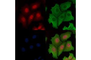 ABIN6261878 and ABIN6266545 staining Hela cells by IF/ICC. (GANP Antikörper  (C-Term))