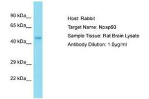 Image no. 1 for anti-Nucleoporin 50kDa (NUP50) (AA 21-70) antibody (ABIN6750333) (NUP50 Antikörper  (AA 21-70))