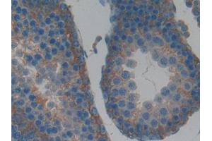 Used in DAB staining on fromalin fixed paraffin- embedded kidney tissue (LIFR Antikörper  (AA 152-291))