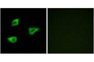 Immunofluorescence analysis of LOVO cells, using CHRM4 Antibody. (CHRM4 Antikörper  (AA 236-285))