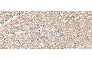 Immunohistochemistry of paraffin-embedded Human brain tissue using TAGLN3 Polyclonal Antibody at dilution of 1:70(x200)