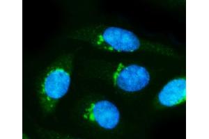 IF analysis of Alpha Internexin/INA using anti-Alpha Internexin/INA antibody (ABIN7602187). (INA Antikörper  (AA 62-169))