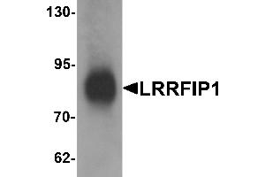 Western blot analysis of LRRFIP1 in human colon tissue lysate with LRRFIP1 antibody at 1 µg/mL. (LRRFIP1 Antikörper  (C-Term))