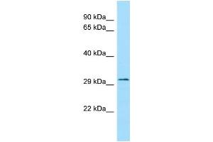 WB Suggested Anti-FLVCR2 Antibody Titration: 1. (FLVCR2 Antikörper  (C-Term))