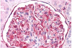 Human Kidney: Formalin-Fixed, Paraffin-Embedded (FFPE)