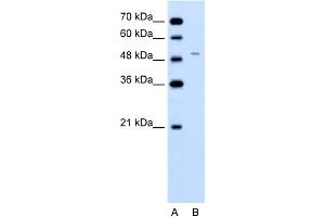 WB Suggested Anti-FECH Antibody Titration:  0. (FECH Antikörper  (N-Term))