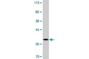 Western Blot detection against Immunogen (36. (AMPD2 Antikörper  (AA 86-185))