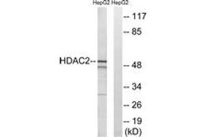 Western blot analysis of extracts from HepG2 cells, using HDAC2 (Ab-394) Antibody. (HDAC2 Antikörper  (AA 360-409))