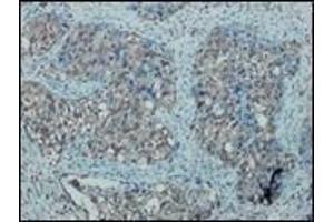 Immunohistochemistry (IHC) image for anti-Nitric Oxide Synthase 2, Inducible (NOS2) antibody (ABIN870300) (NOS2 Antikörper)