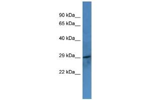 Western Blotting (WB) image for anti-Coagulation Factor VII (F7) (C-Term) antibody (ABIN2788316) (Factor VII Antikörper  (C-Term))