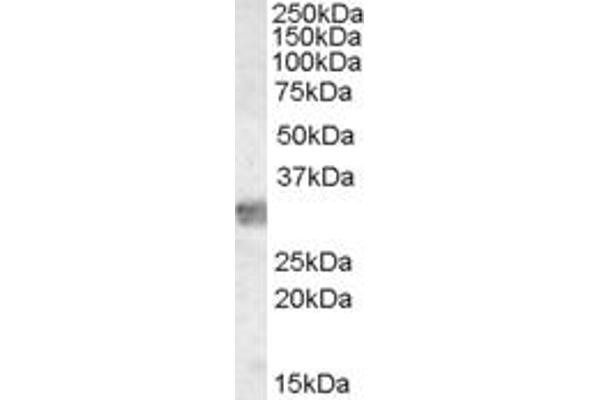 MYD88 Antikörper  (Internal Region)