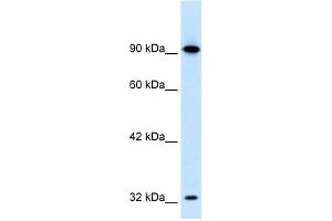 WB Suggested Anti-SOX30 Antibody Titration:  0. (SOX30 Antikörper  (Middle Region))