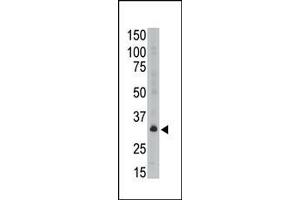 The anti-GEA6 C-term Antibody (ABIN390109 and ABIN2840621) is used in Western blot to detect GEA6 in A549 lysate.