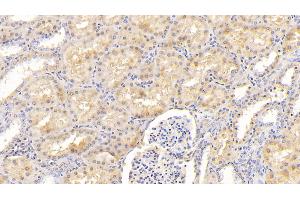 Detection of F12 in Human Kidney Tissue using Polyclonal Antibody to Coagulation Factor XII (F12) (F12 Antikörper  (AA 400-615))
