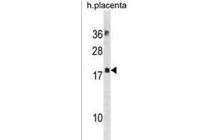 MYL12B Antibody (N-term) (ABIN1881561 and ABIN2838709) western blot analysis in human placenta tissue lysates (35 μg/lane).