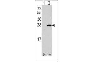 Image no. 1 for anti-sigma Non-Opioid Intracellular Receptor 1 (SIGMAR1) (Middle Region) antibody (ABIN357897) (SIGMAR1 Antikörper  (Middle Region))