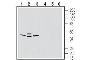 Western blot analysis of rat brain membranes (lanes 1 and 4), mouse brain lysates (lanes 2 and 5) and rat lung membranes (lanes 3 and 6):1-3. (G Protein-Coupled Receptor 183 (GPR183) Peptid)