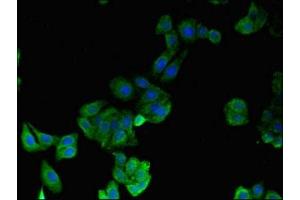 Immunofluorescence (IF) image for anti-Hydroxyprostaglandin Dehydrogenase 15-(NAD) (HPGD) (AA 14-130) antibody (ABIN7142110)