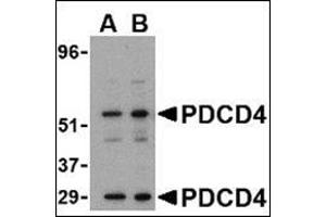 Western blot analysis of PDCD4 in A-20 cell lysate with this product at (A) 0. (PDCD4 Antikörper  (C-Term))